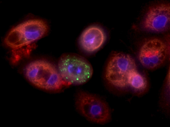 Lung cells infected with coronavirus. Credit: Yaakov Nahmias