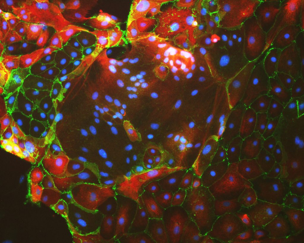 Placenta multinucleated cells | Credit: Moriyah Naama, Hebrew University Buganim Lab