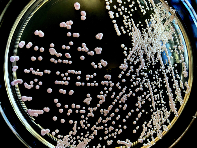 Candida glabrata can cause sepsis, especially among patients with compromised immune system.