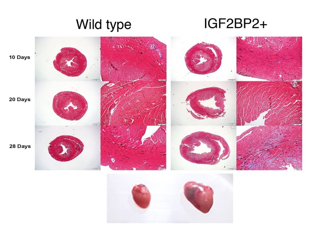 Development of dilated cardiomyopathy in biological model expressing IGF2BP2