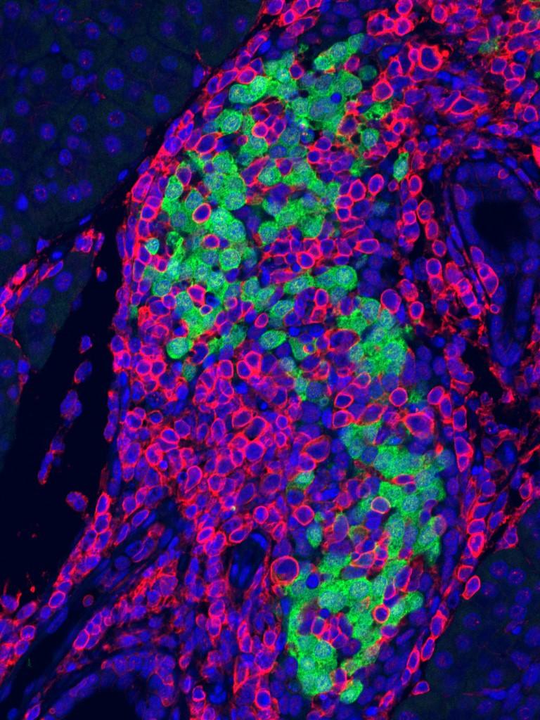 Disrupted RNA. Credit: Yuval Dor