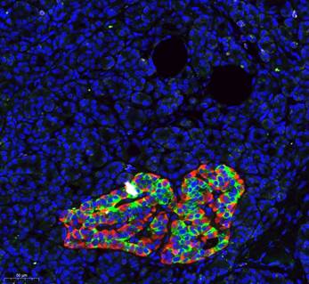 Histological image of the human pancreas, stained with antibodies against insulin (green) and glucagon (red), together marking an islet of Langerhans. Blue labels DNA, marking the nuclei of all pancreatic cells.